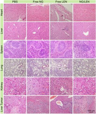 Intracellular Reduction-Responsive Molecular Targeted Nanomedicine for Hepatocellular Carcinoma Therapy